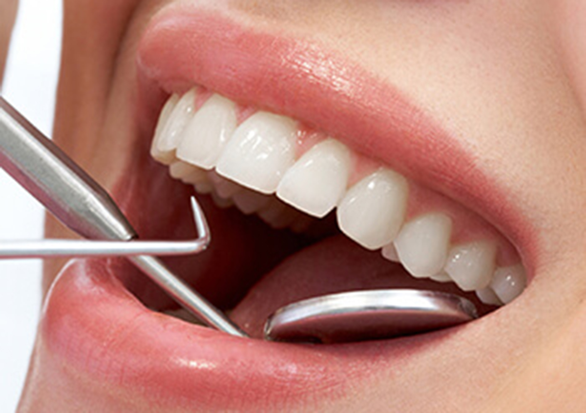 Obtain A Dental Cleaning For The Teeth In Glen Mills PA Facility Area