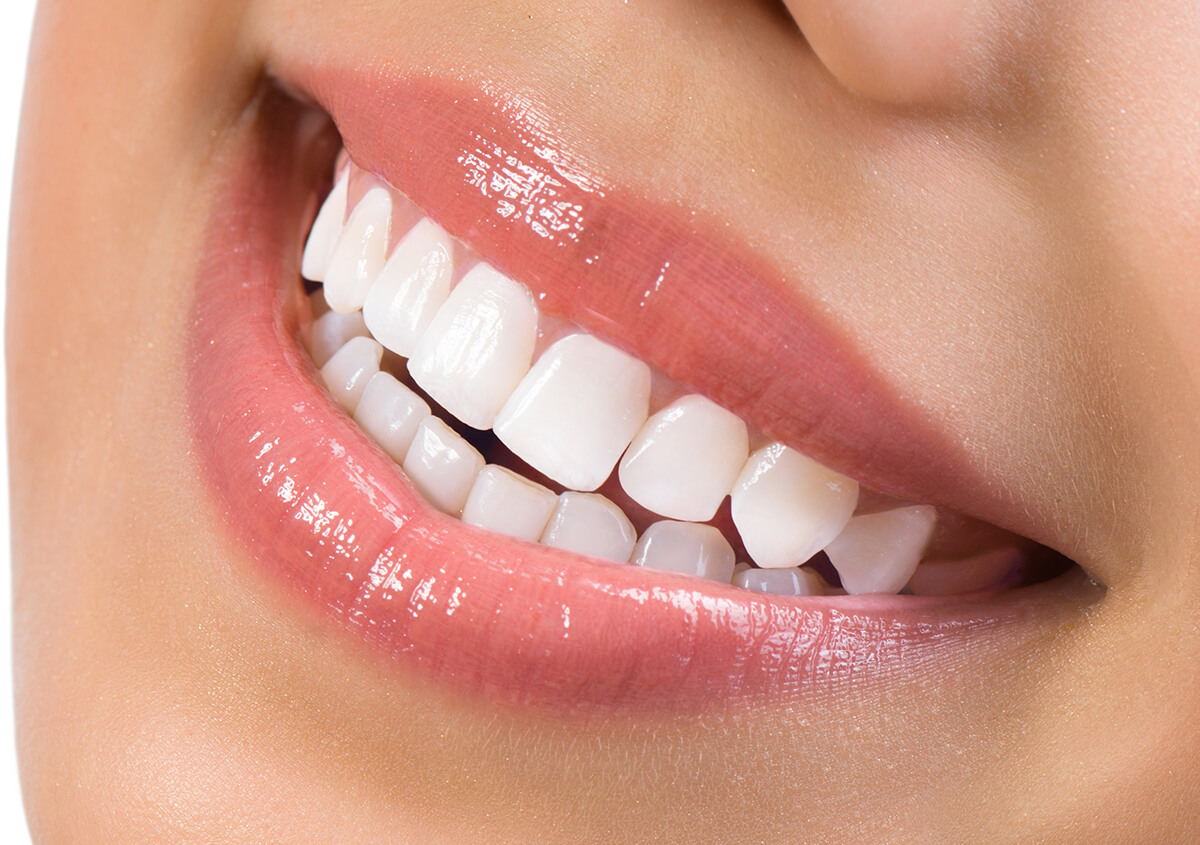 Cosmetic Dental Bonding Benefits in Glen Mills PA Area