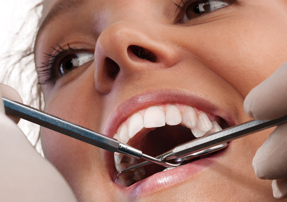 Teeth Cleaning Dentist in Glen Mills PA Area
