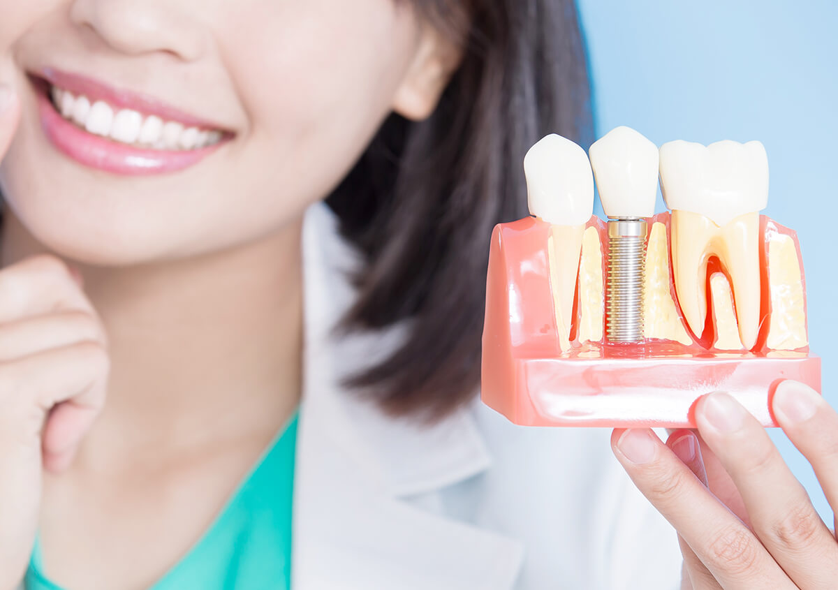 Tooth Implant Dentist in Glen Mills PA Area